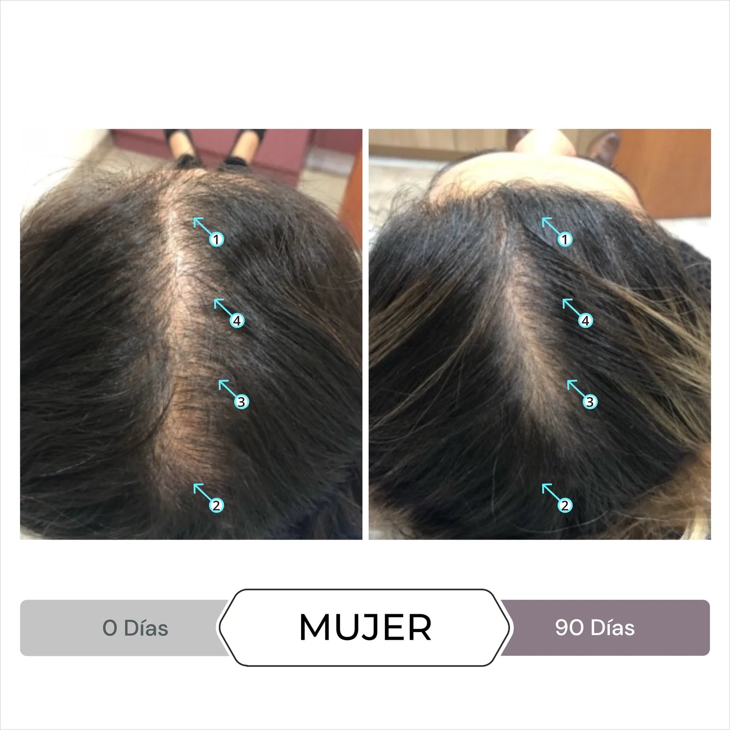 DS Labs Spectral CSF Serum Anticaida 60 mL