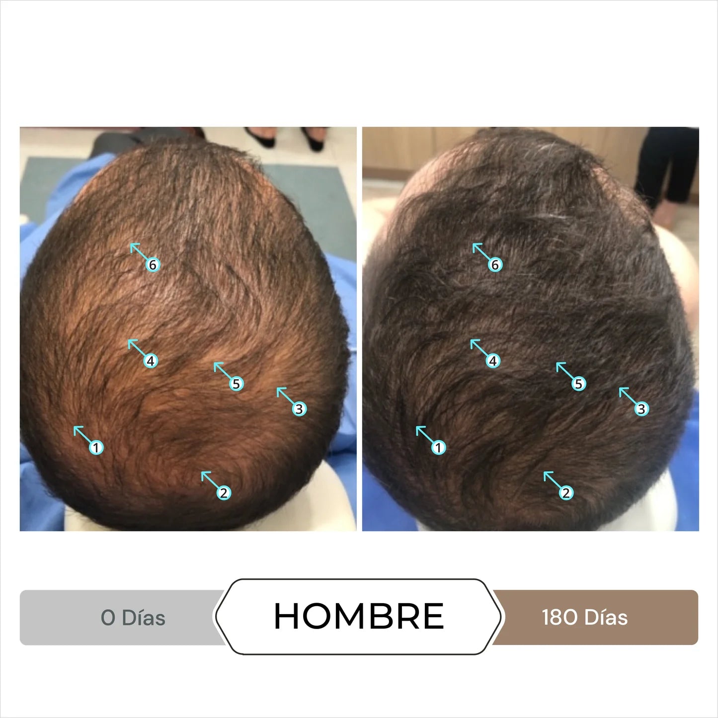 DS Labs Spectral DNC-N Serum Anticaida 60 mL