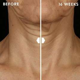 Skinceuticals Tripeptide-R Neck Repair 50mL