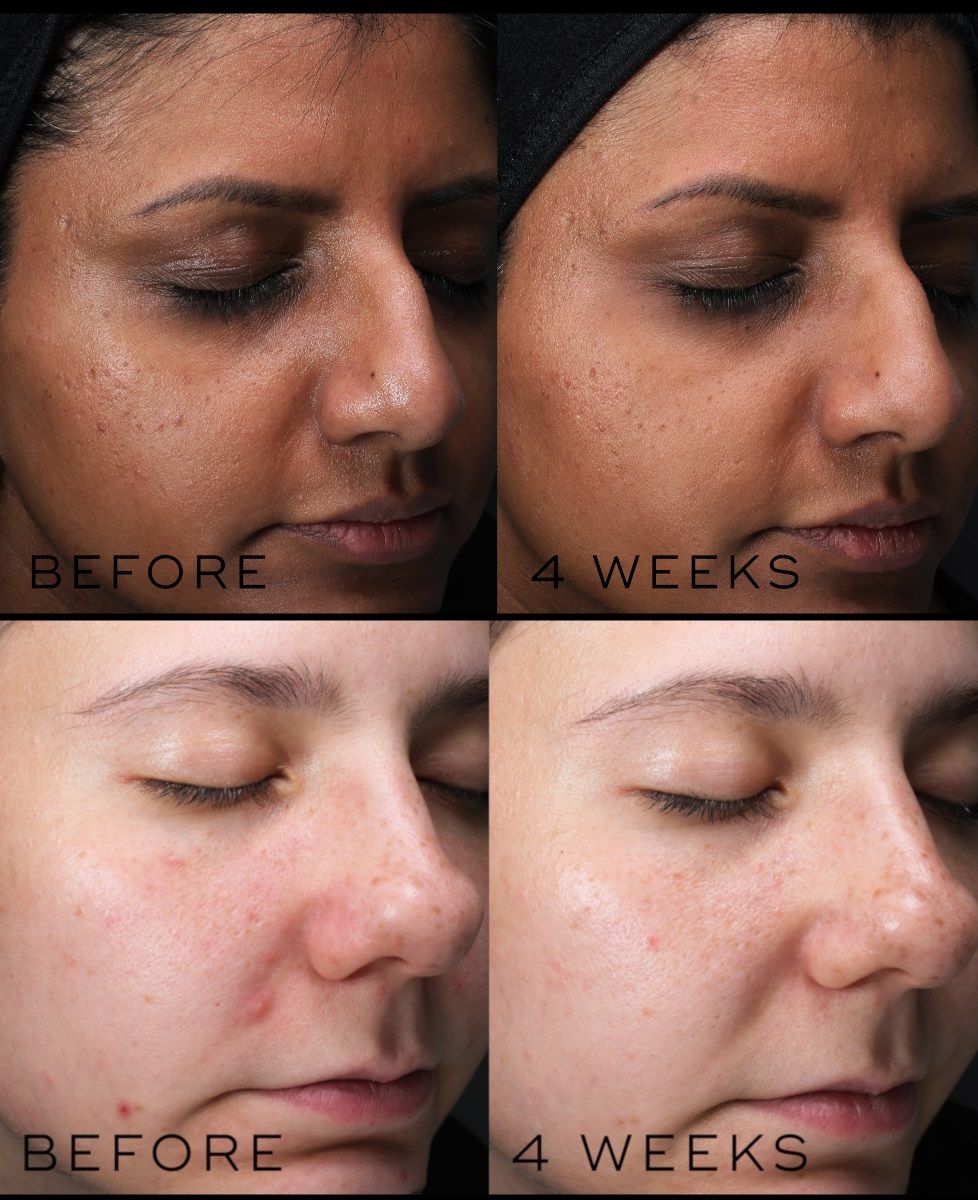 Medik8 Clarity Peptides 30mL